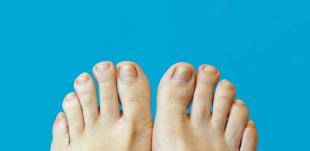 Foot Health